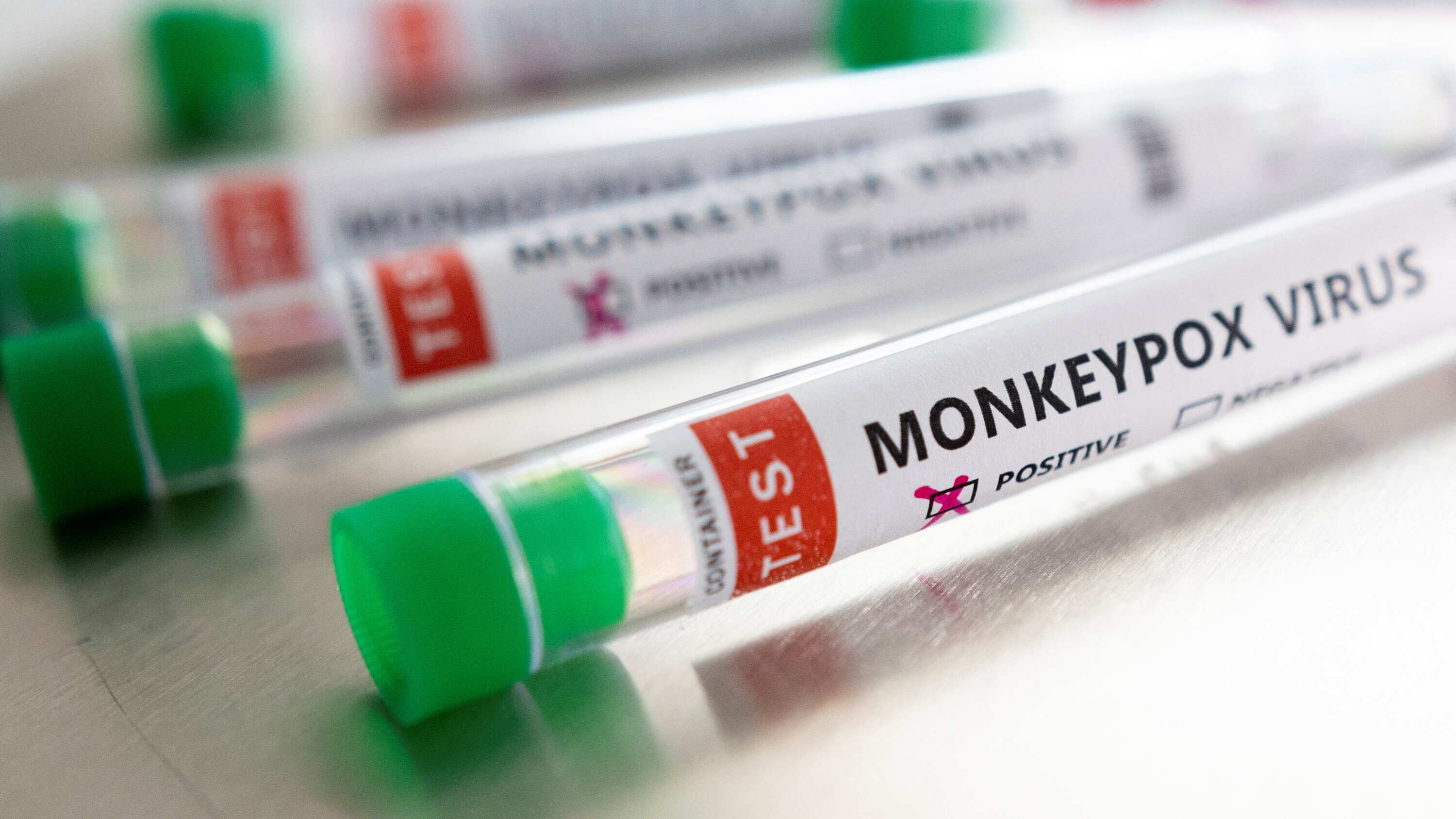 Argentina reports first Monkeypox case as Russia alleges US role in the ...