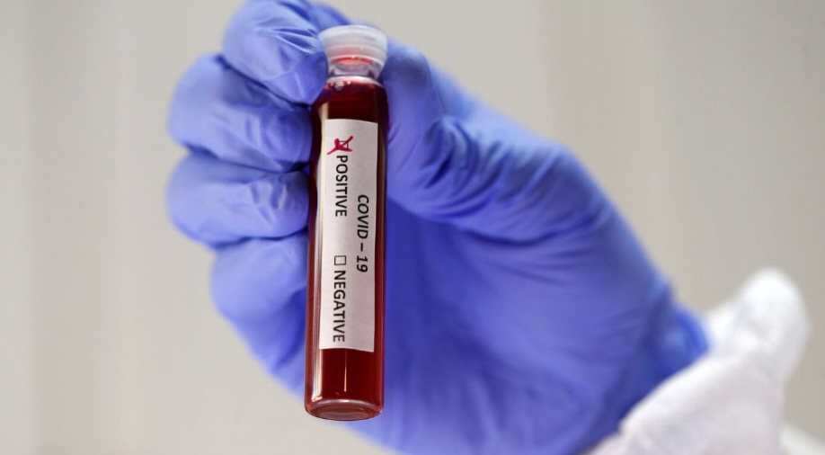Coronavirus