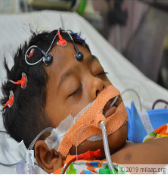 Radesh