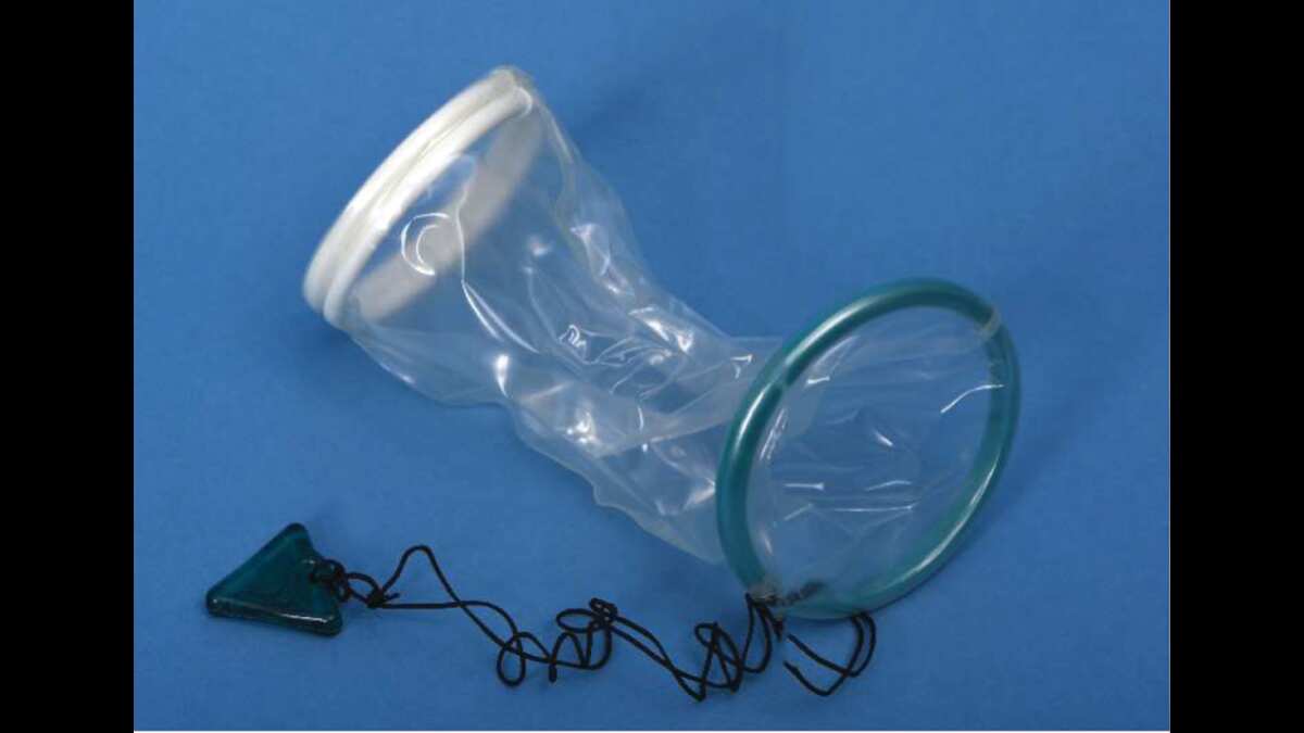 An Alexis retractor