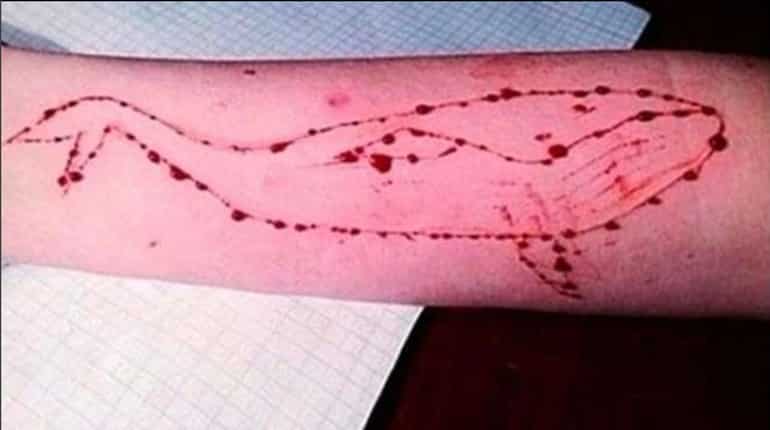 Assam student hospitalised after suicide attempt as part of Blue Whale challenge