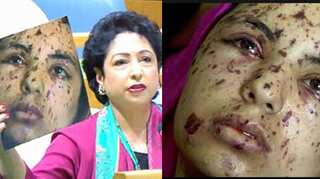 Pakistan's blooper: UN envoy uses injured Palestinian's pic as 'evidence' of atrocities in Kashmir