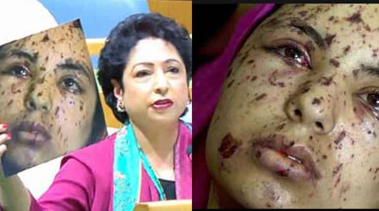 Pakistan's blooper: UN envoy uses injured Palestinian's pic as 'evidence' of atrocities in Kashmir