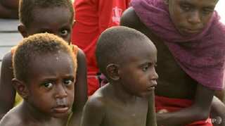 100 in Indonesia's Papua feared dead from malnutrition, measles