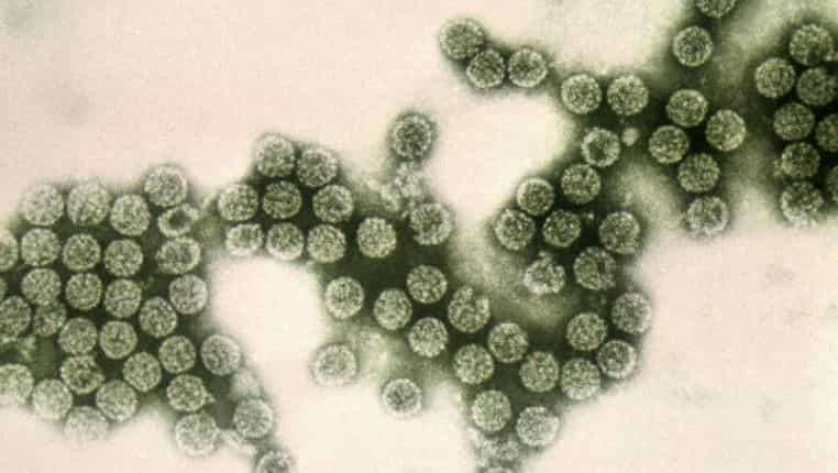 Listeriosis outbreak: Death toll jumps to 172 in South Africa Listeriosis outbreak: Death toll jumps to 172 in South Africa