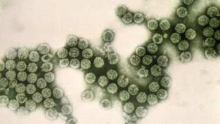 Listeriosis outbreak: Death toll jumps to 172 in South Africa