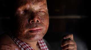 Jilted Pakistani woman 'throws acid on boyfriend for refusing marriage'