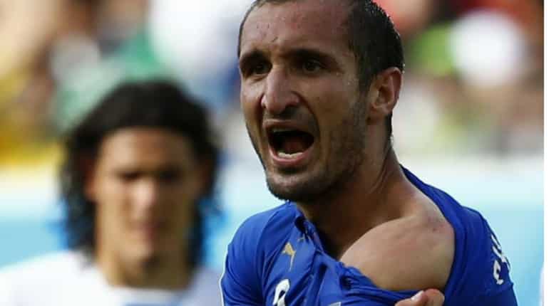 Giorgio Chiellini shows his shoulder