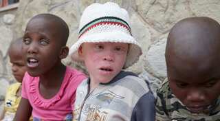 An island refuge for Tanzania's albinos