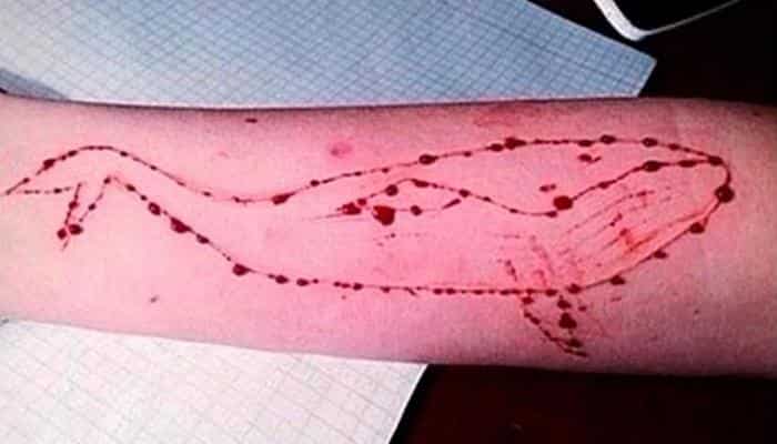 'Blue Whale' challenge echoes in Rajya Sabha 'Blue Whale' challenge echoes in Rajya Sabha
