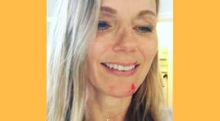 Geri Horner, former Spice Girl singer attacked by her own cat