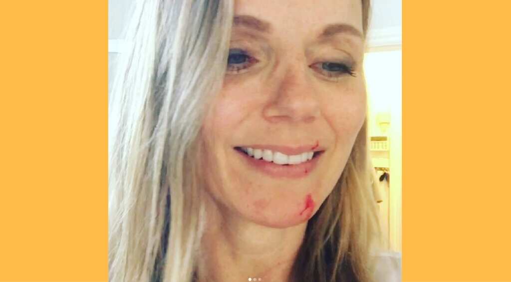 Geri Horner, former Spice Girl singer attacked by her own cat