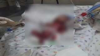 Newborn, declared dead by Delhi hospital, found alive by parents