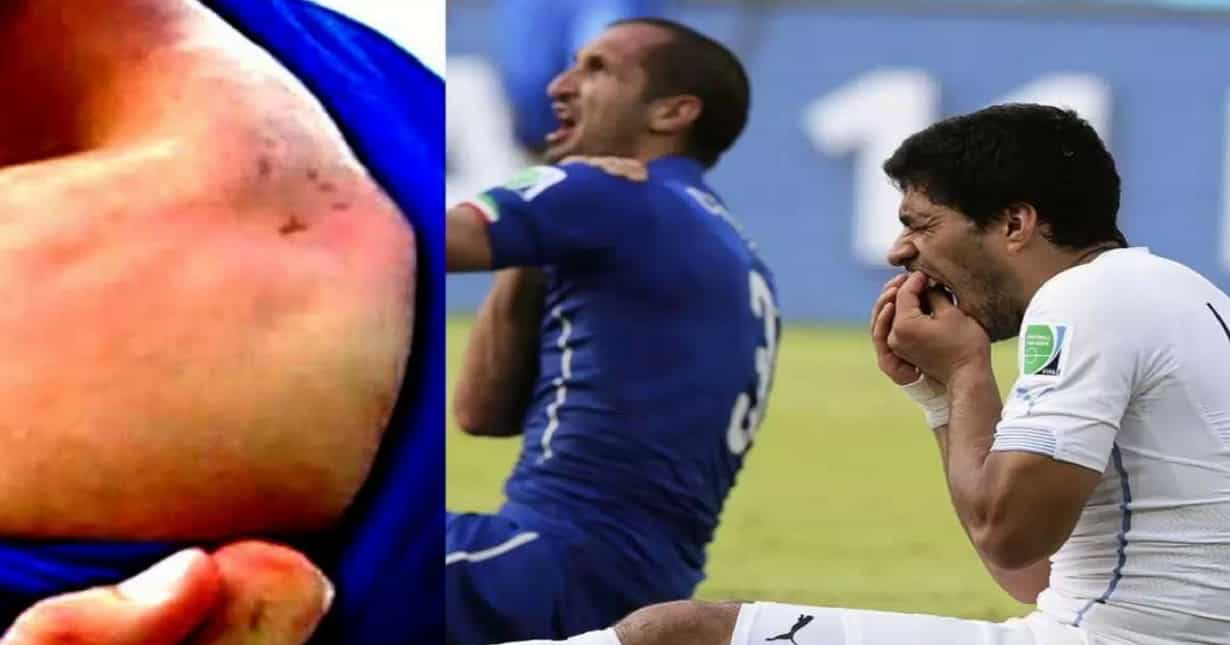 Suarez was hungry
