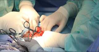 UK surgeon admits branding patient livers with initials