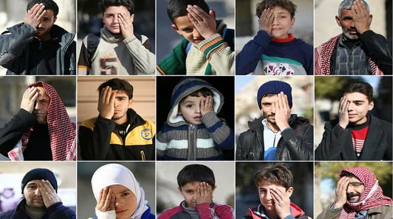Blinded in one eye, Syrian baby becomes symbol of siege Blinded in one eye, Syrian baby becomes symbol of siege