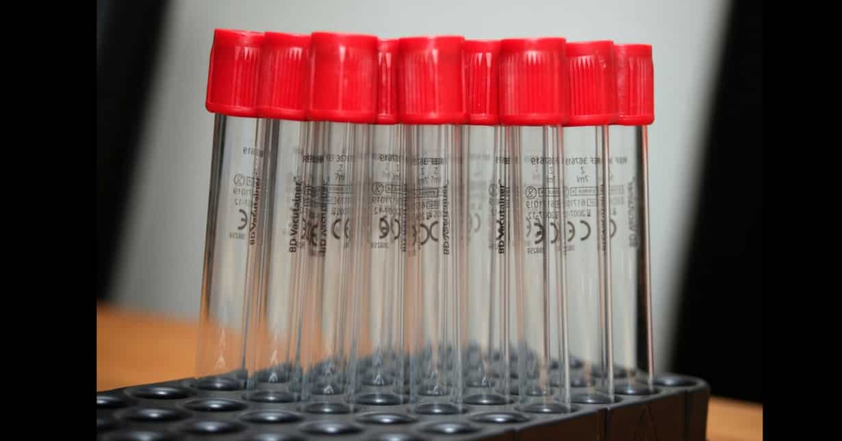 Doping: WADA confirms flaw in sample bottles Doping: WADA confirms flaw in sample bottles