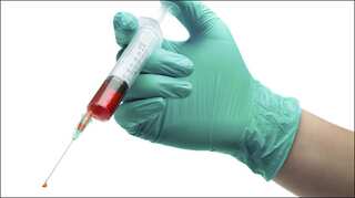 United States and Gates Foundation plan $200m for sickle cell, HIV cures