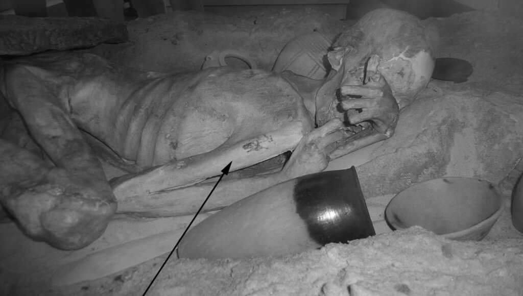 Experts discover world's oldest tattoos on 5000-year-old Egyptian mummies