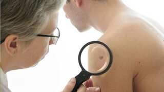 Melanoma skin cancer numbers reach record high in UK, shows study