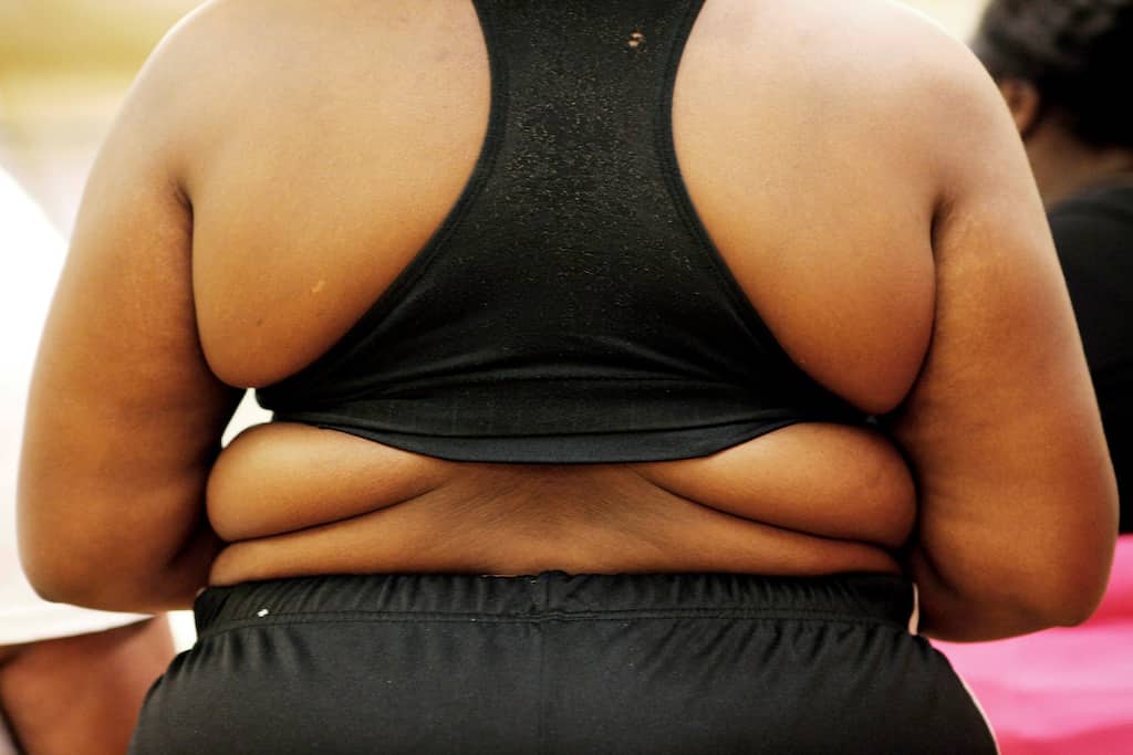 WHO panel split on soft drink sugar tax to cut obesity