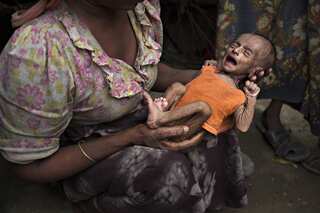 One third kids under two years of age in developing countries are nourished, says UNICEF