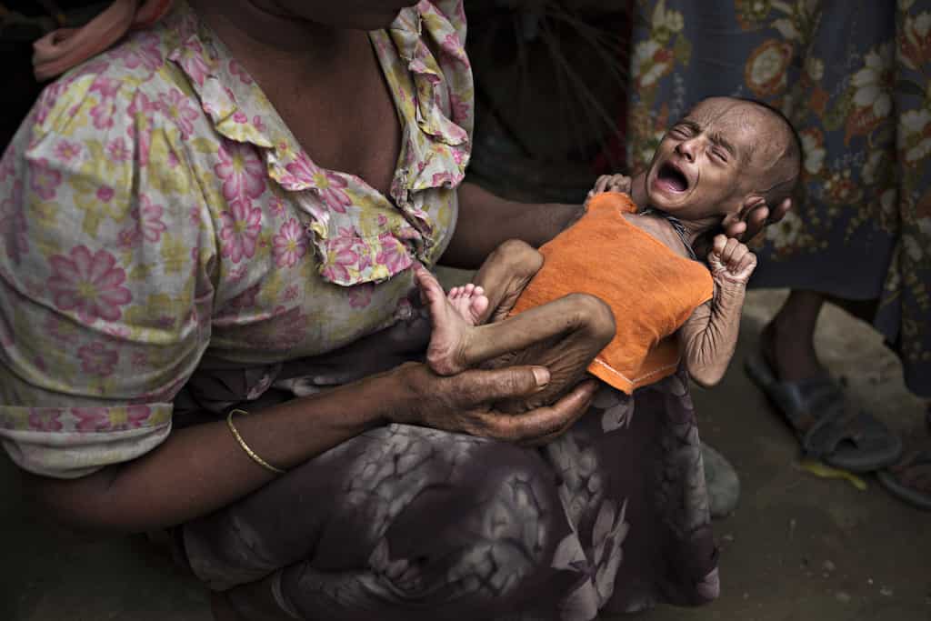 One third kids under two years of age in developing countries are nourished, says UNICEF