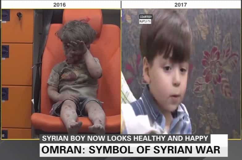 Aleppo boy whose picture shocked the world now looks fit, healthy ...