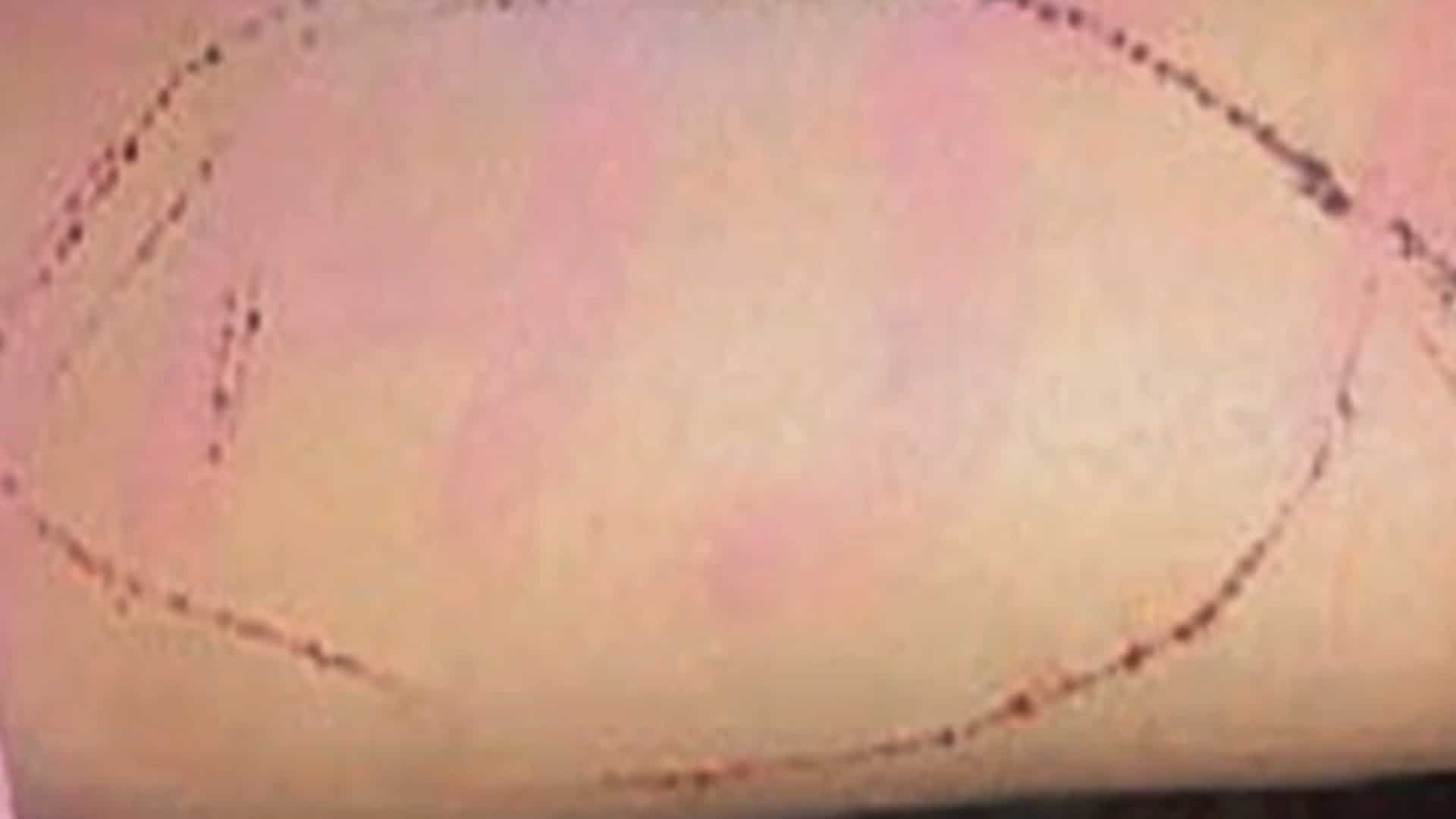VIDEO: Another Blue Whale victim? 17-year-old daughter of BSF soldier attempts suicide VIDEO: Another Blue Whale victim? 17-year-old daughter of BSF soldier attempts suicide
