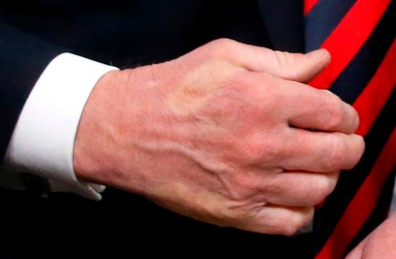 Watch: Macron may have put 'too much pressure' on Trump at G7, leaves thumb imprint