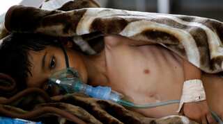 'One step away from starvation': UN warns over 30 million could die of hunger