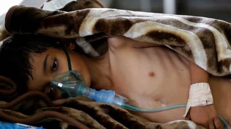 'One step away from starvation': UN warns over 30 million could die of hunger