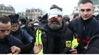 Yellow vest activist handicapped for life after getting hit by rubber bullet: Lawyer