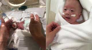 Japan: 'Smallest baby' who weighed same as large onion, leaves hospital healthy