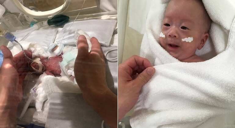 Japan: 'Smallest baby' who weighed same as large onion, leaves hospital healthy