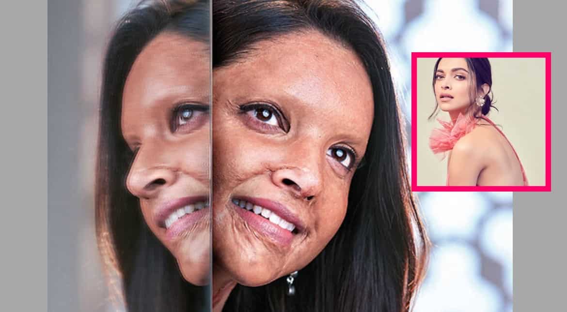 First look of Deepika Padukone as acid attack survivor in 'Chhapaak' is out