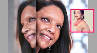 First look of Deepika Padukone as acid attack survivor in 'Chhapaak' is out