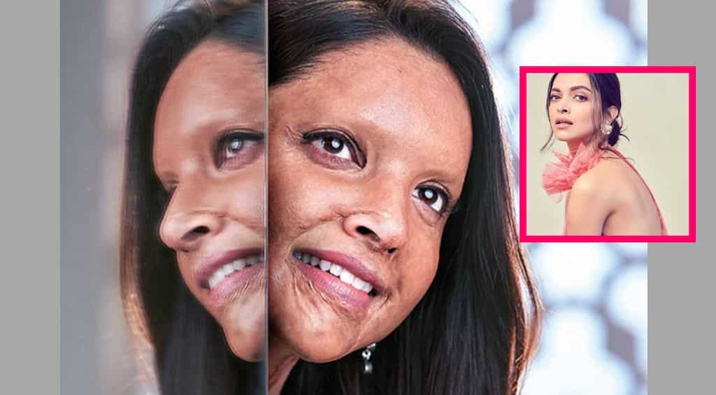 First look of Deepika Padukone as acid attack survivor in 'Chhapaak' is out