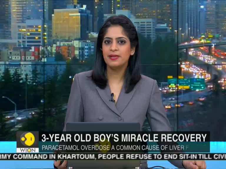 Complex support therapy helps 3-year-old boy survive liver failure