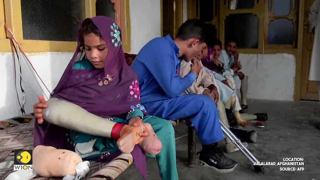 Surviving loss in Afghanistan: A family of amputees