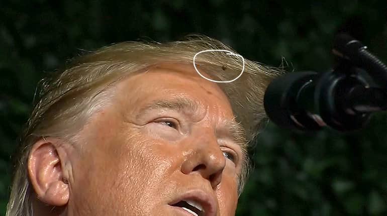 Is that a fly in Trump's hair?