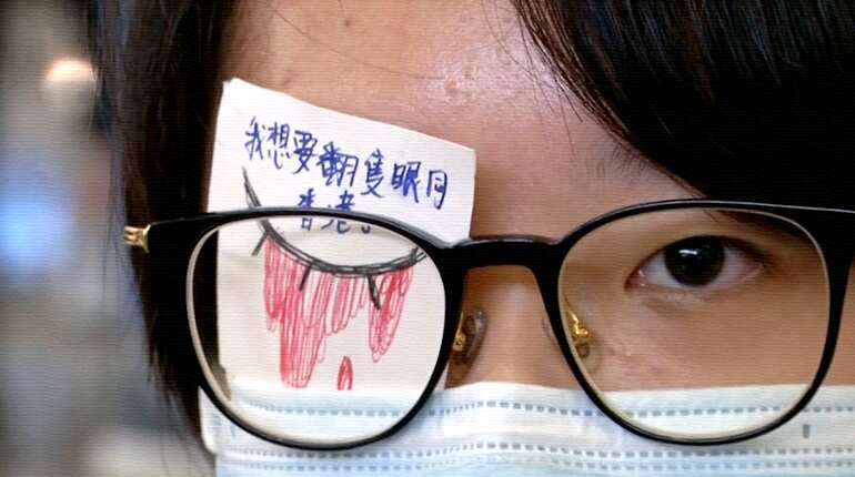 'We do not tolerate violence from police' - Hong Kong's eye-patch protesters