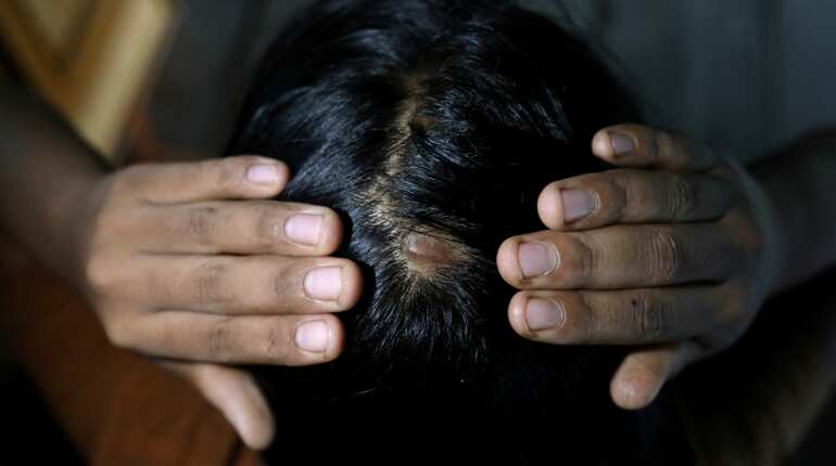 'Until her bones are broken': Myanmar activists fight to outlaw domestic violence