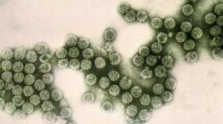 Legionnaires' disease: Health officials investigating cluster in New York