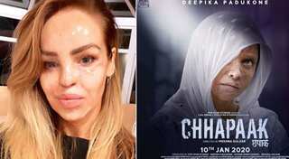 Deepika Padukone's 'Chhapaak' trailer gets a thumbs up from British model Katie Piper