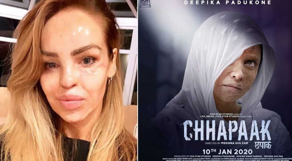 Deepika Padukone's 'Chhapaak' trailer gets a thumbs up from British model Katie Piper