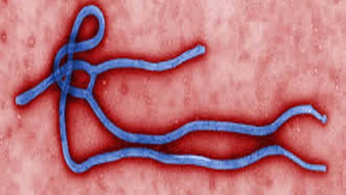 Ebola outbreak declared in Uganda by WHO Ebola outbreak declared in Uganda by WHO