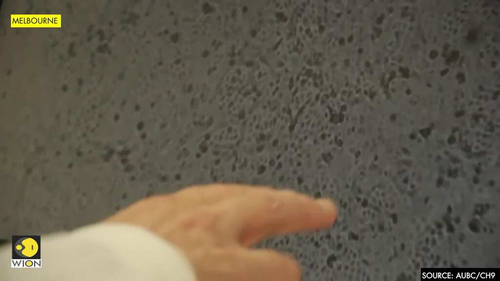 Australian scientist claims lab version of virus