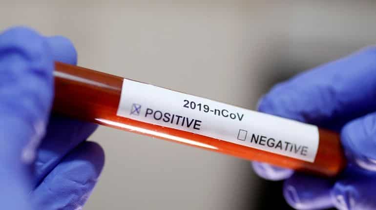 Chinese authorities ignored early reports of 'mysterious' coronavirus by doctor: Report