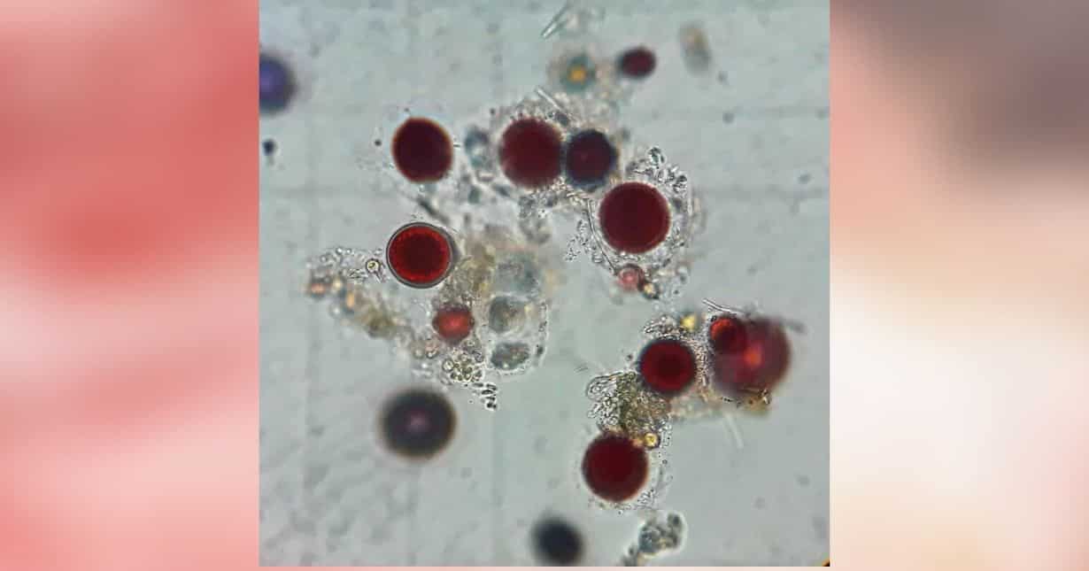 'Chlamydomonas nivalis'
